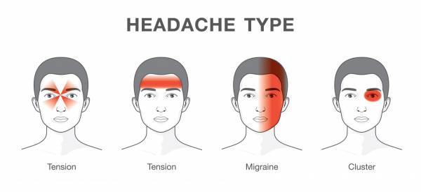 migraine fréquente types de maux de tête