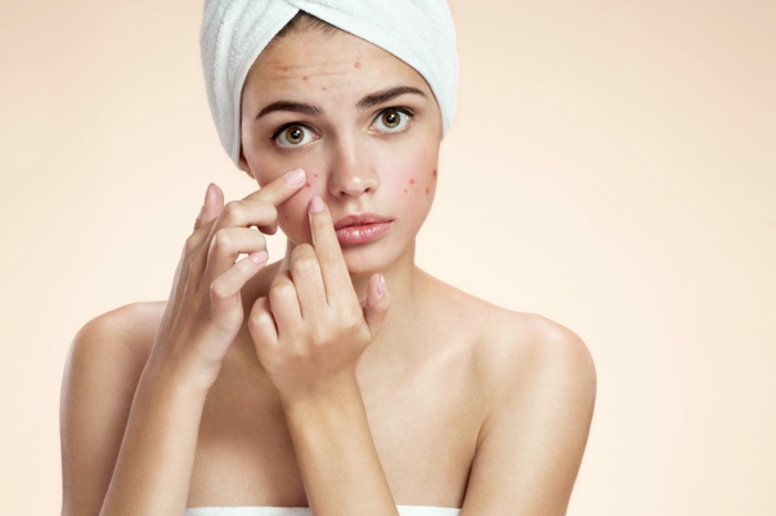 hamamélis peau acnéique comment traiter